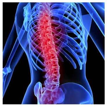 Spinal-Cord-Injury